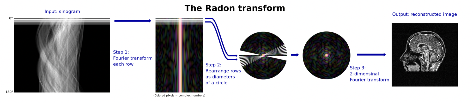 Radon变换重建流程